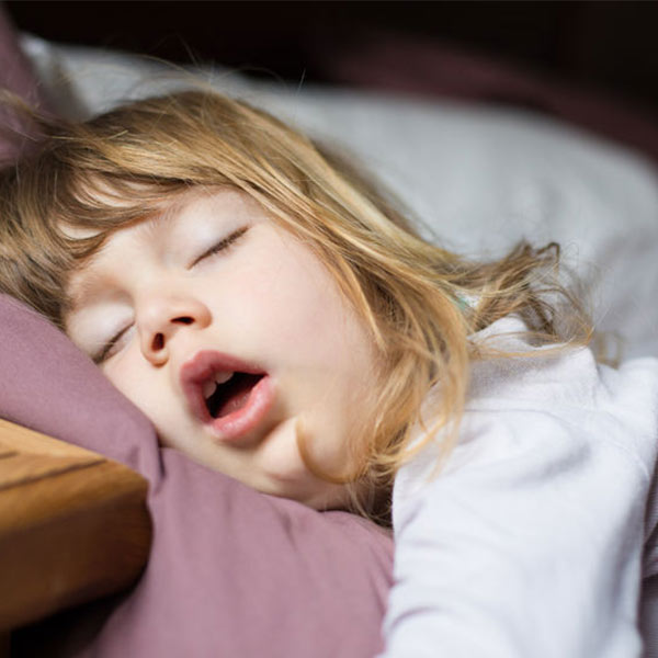 Mouth breathing caused by Sleep Apnea